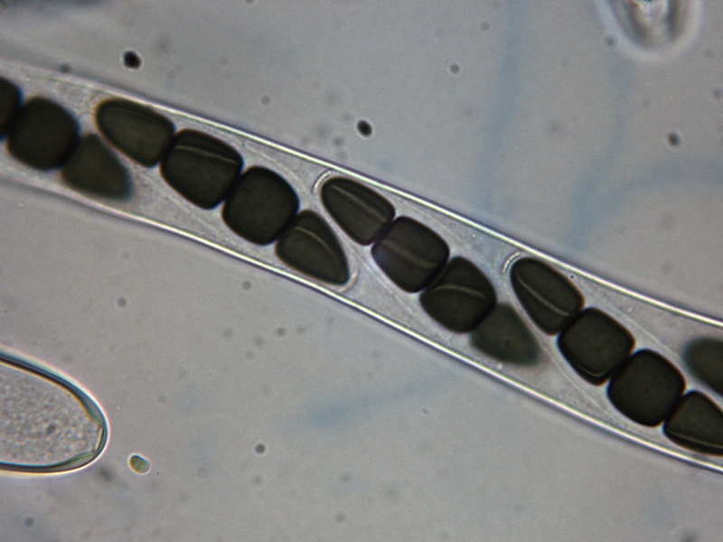 Sporormiella pilosa Coprophile Pilze Pilzforum.eu